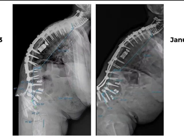 spinal imaging
